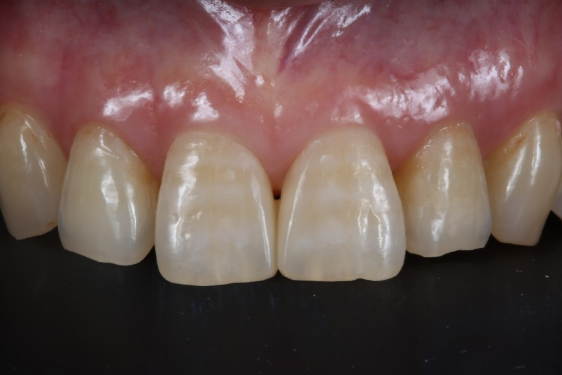 After image