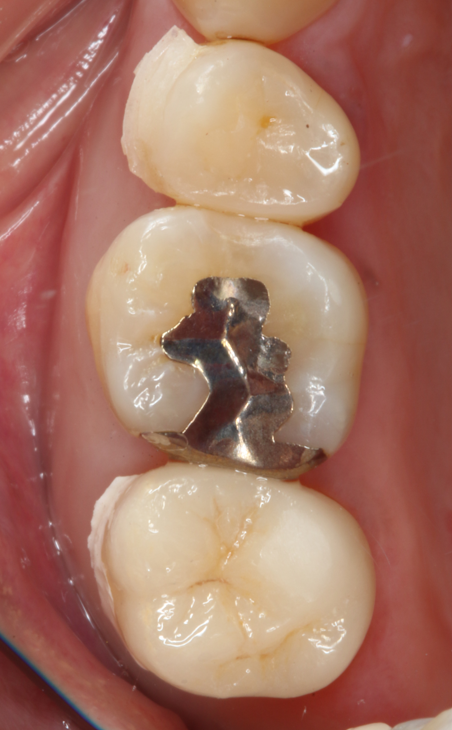 Before image