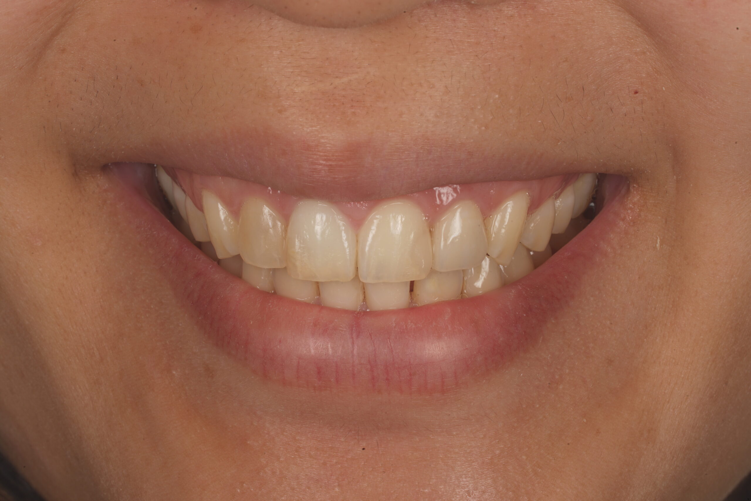 After image