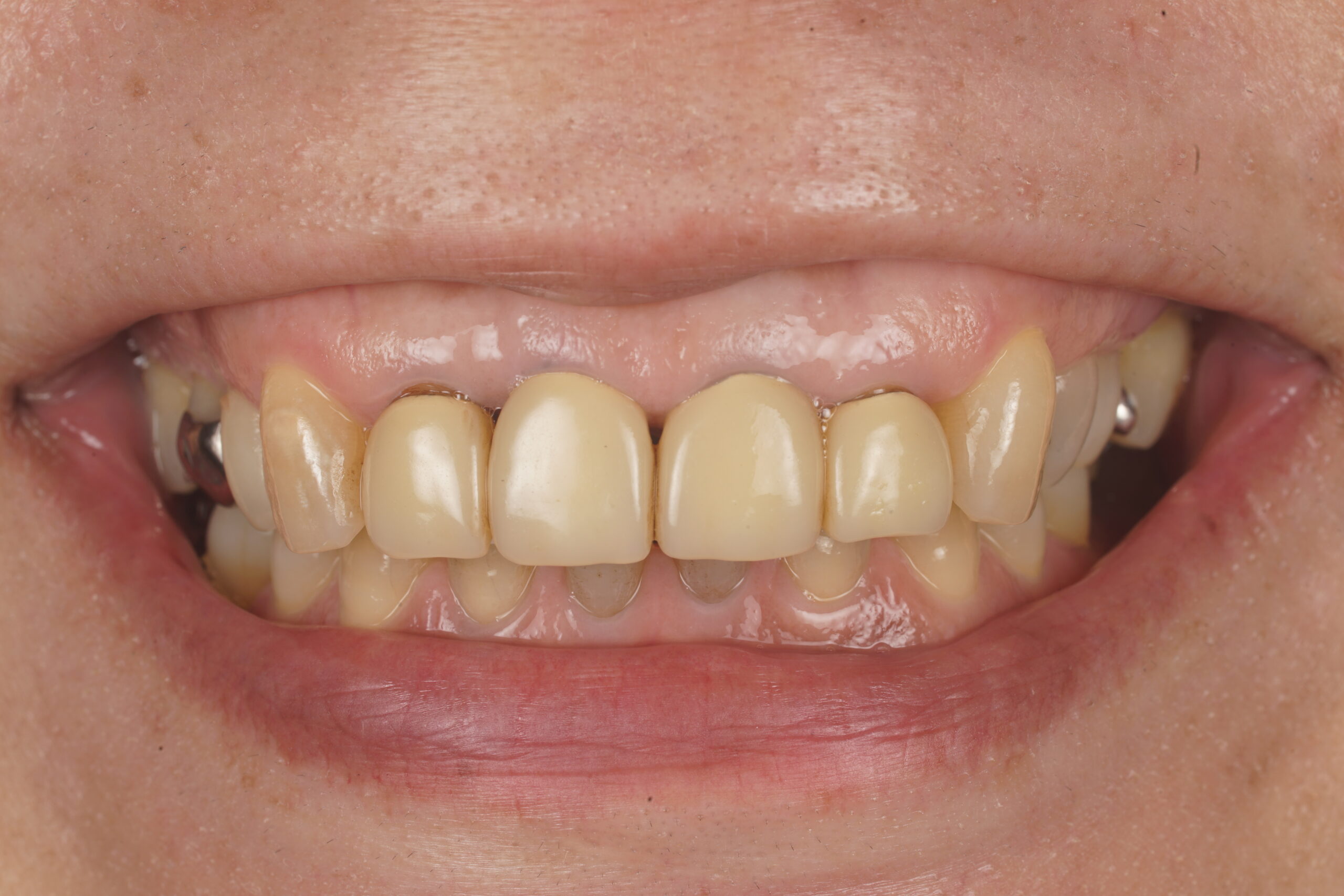 Before image