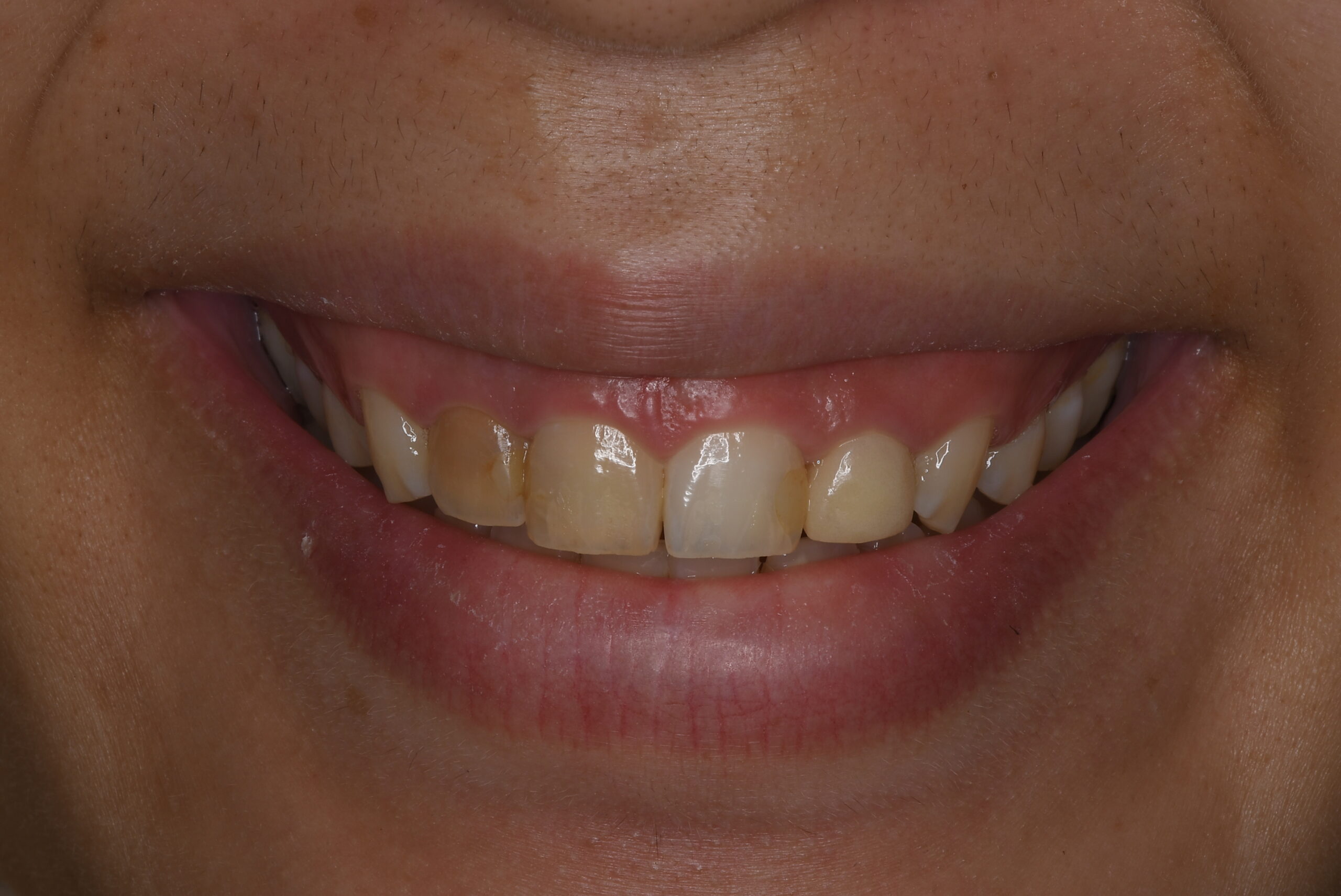 Before image