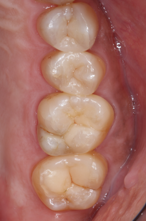 After image