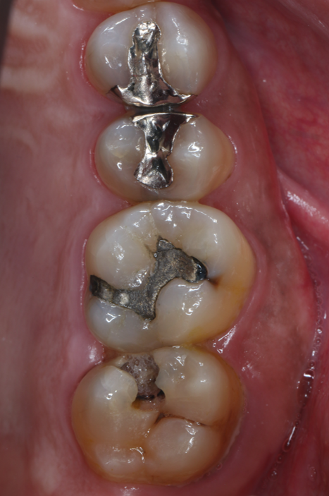 Before image