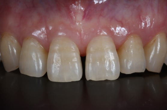 Before image