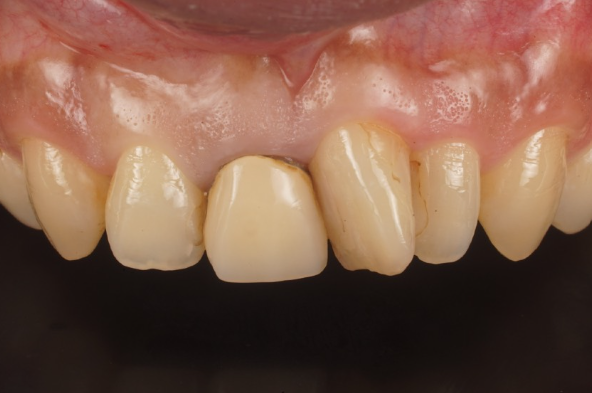 Before image