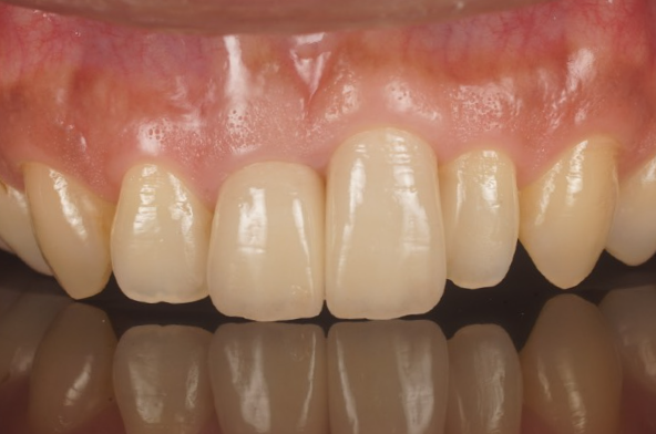 After image