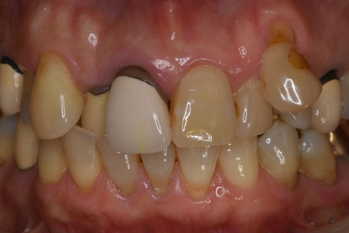 Before image