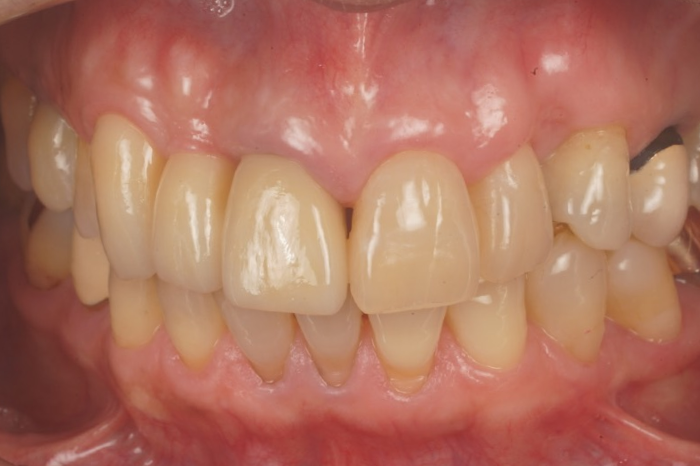 After image