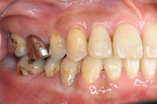 Before image