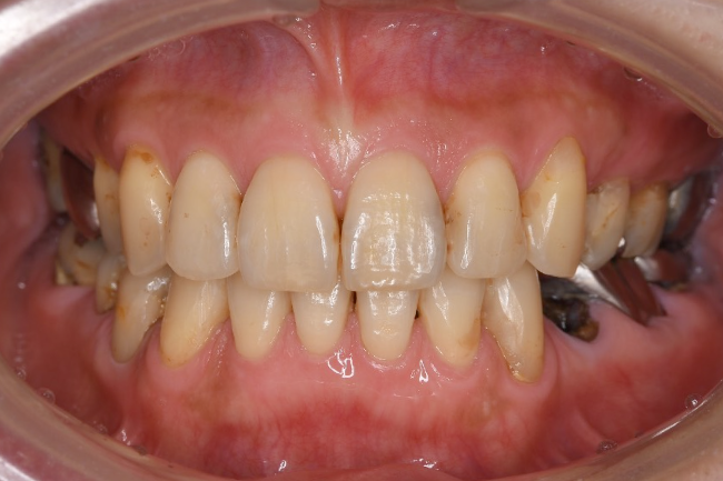 Before image