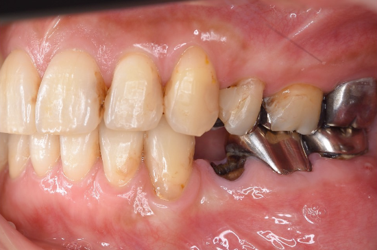 Before image