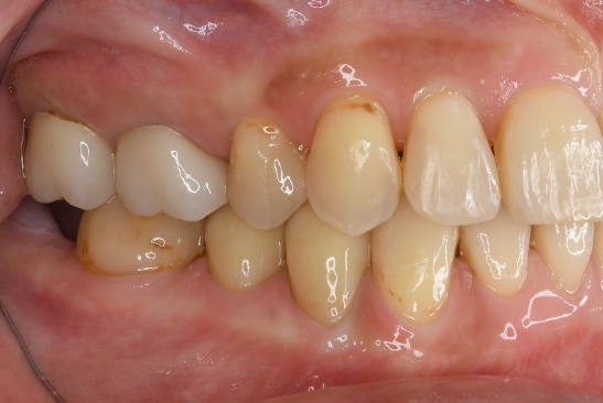 After image