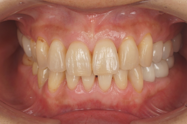 After image