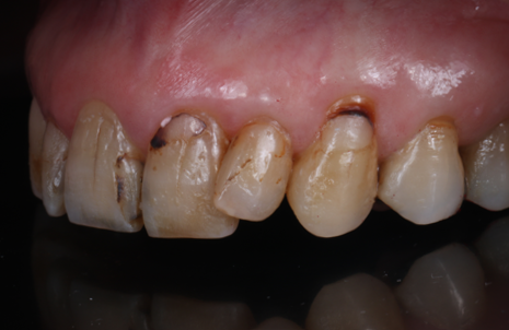 Before image