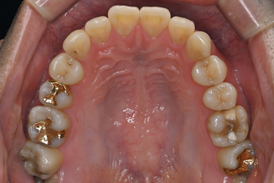 Before image