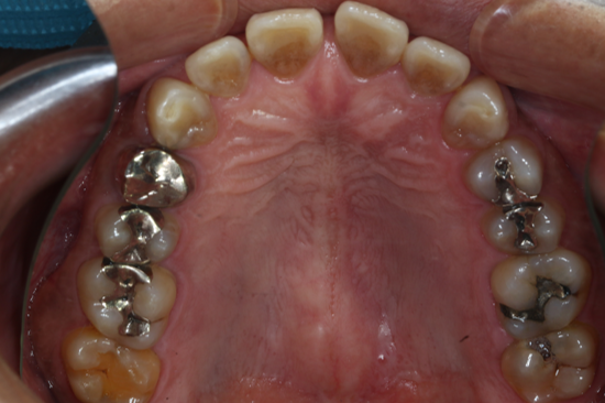 Before image