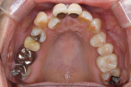Before image