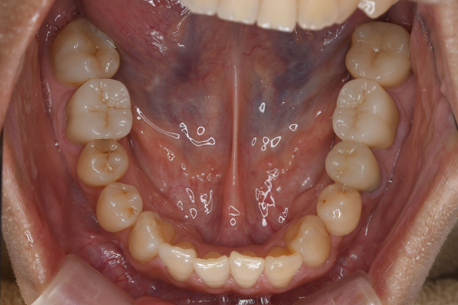 After image