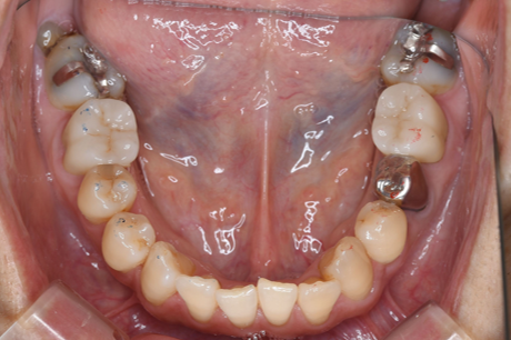 Before image