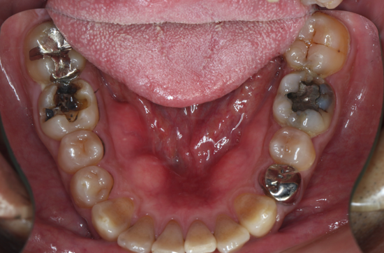 Before image