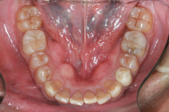 After image