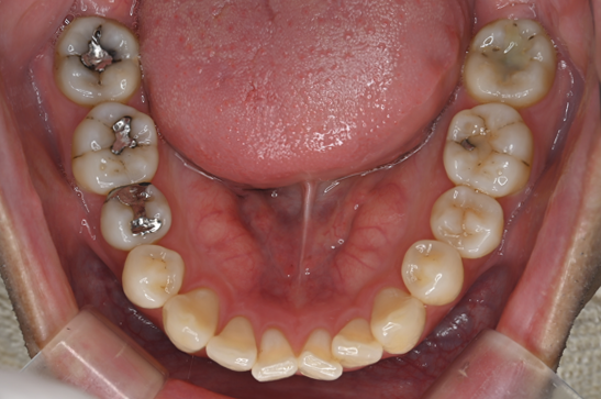 Before image
