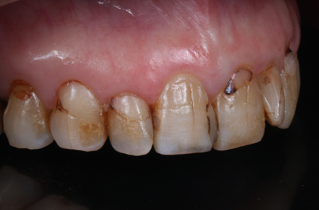 Before image