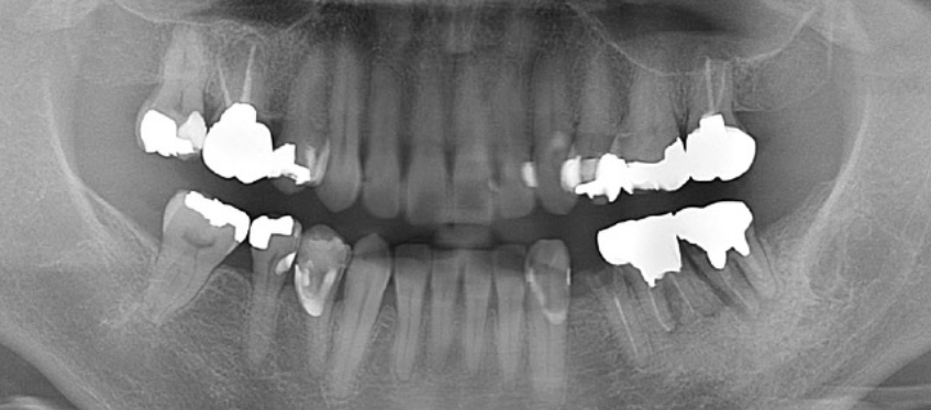 Before image