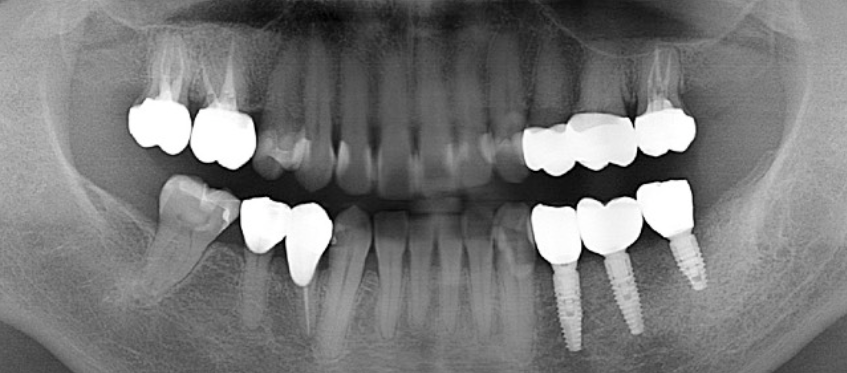 After image