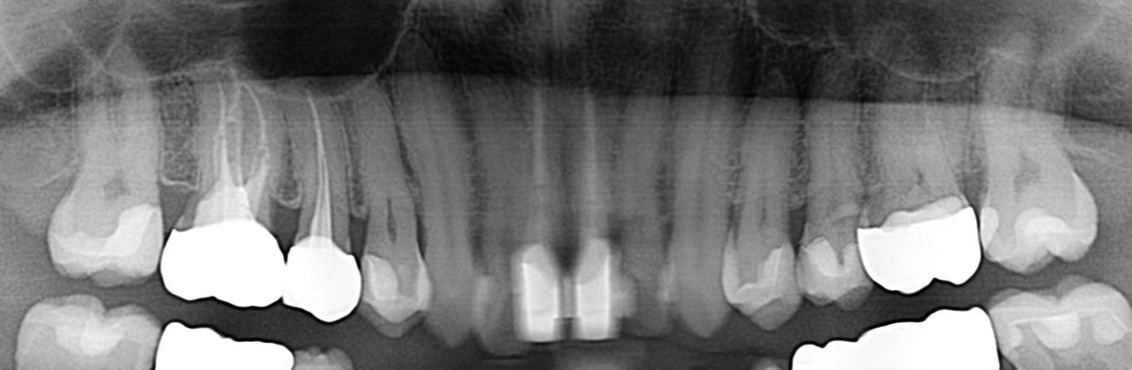 After image