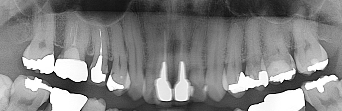 Before image
