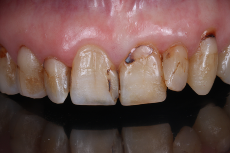 Before image