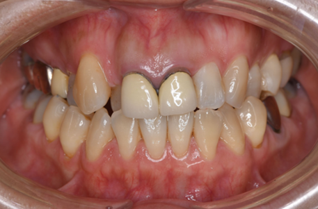 Before image