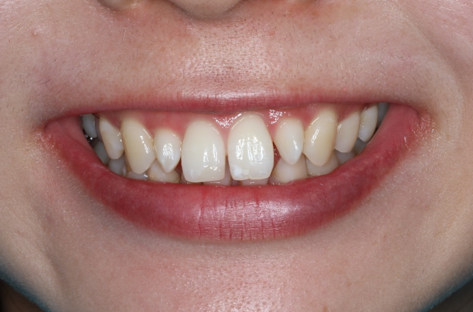 Before image