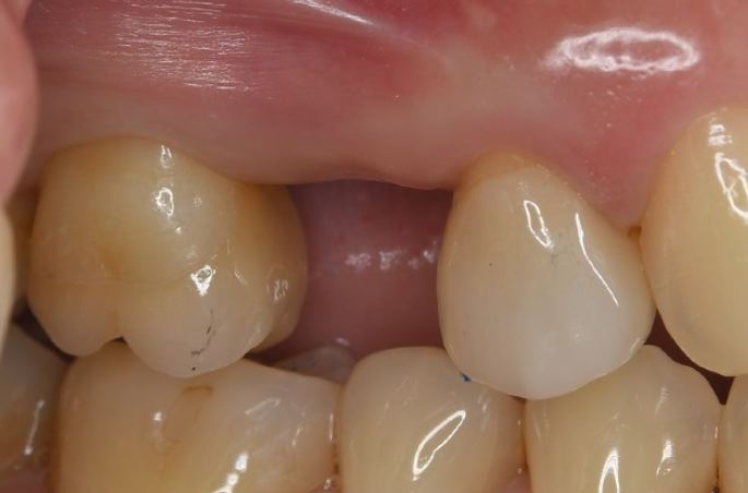 Before image