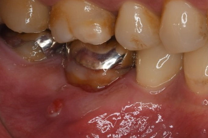 Before image