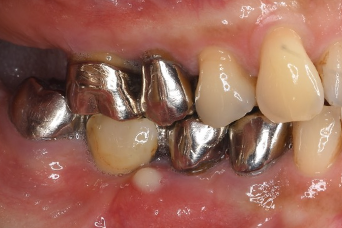 Before image