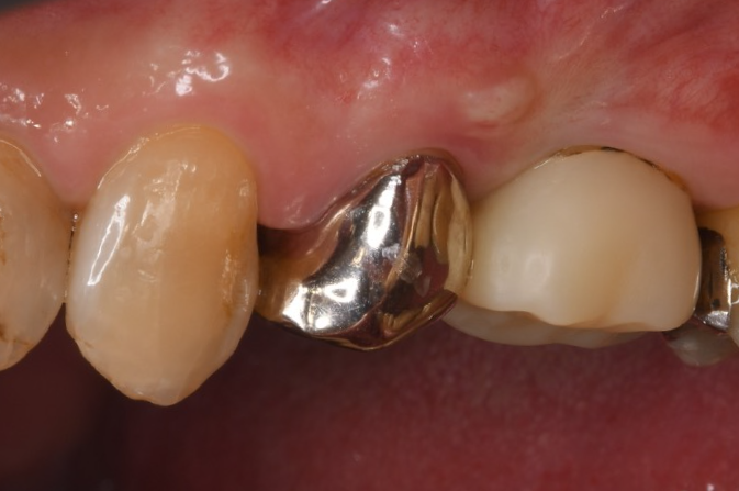 Before image