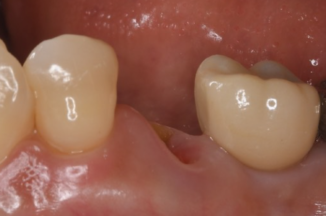 Before image