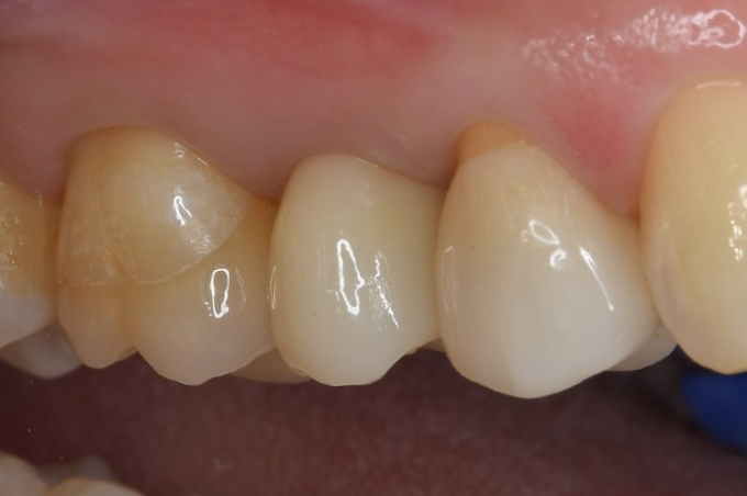 After image