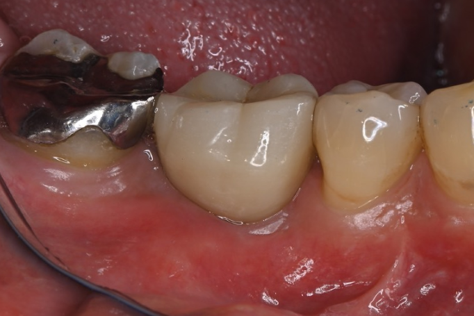 After image