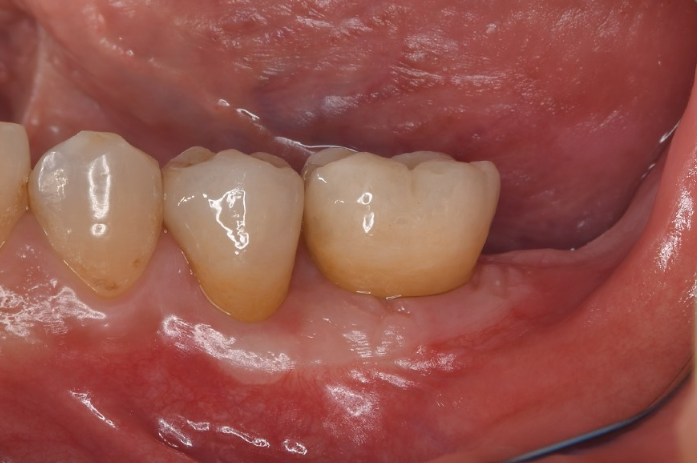 After image
