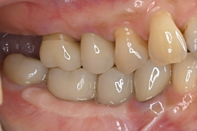 After image