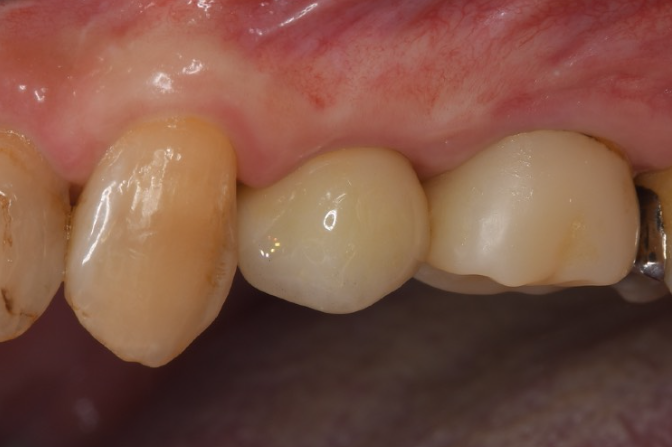 After image