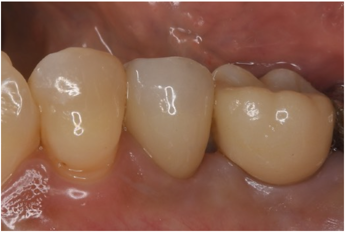 After image