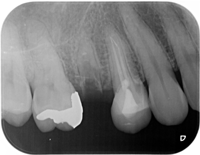 Before image