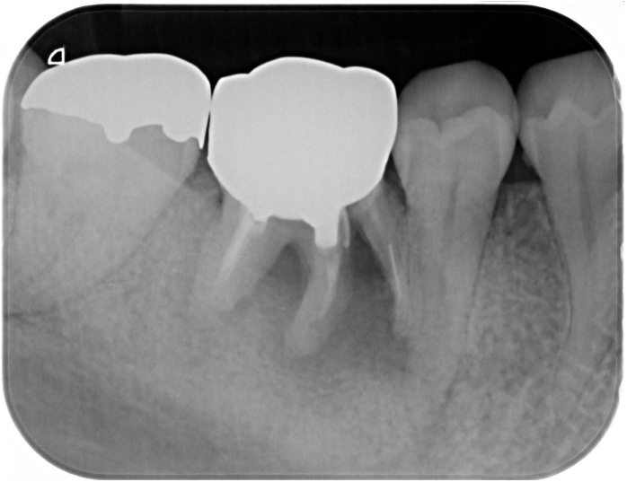 Before image