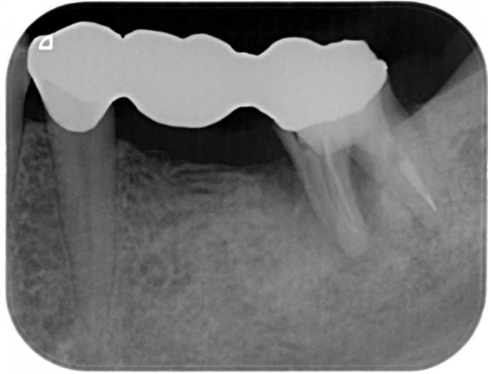 Before image