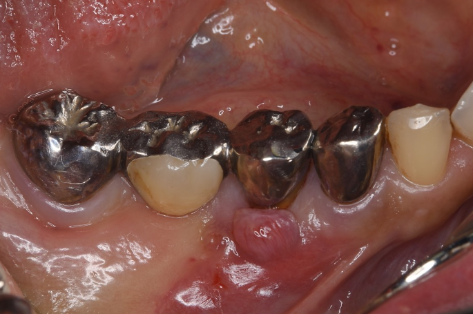 Before image