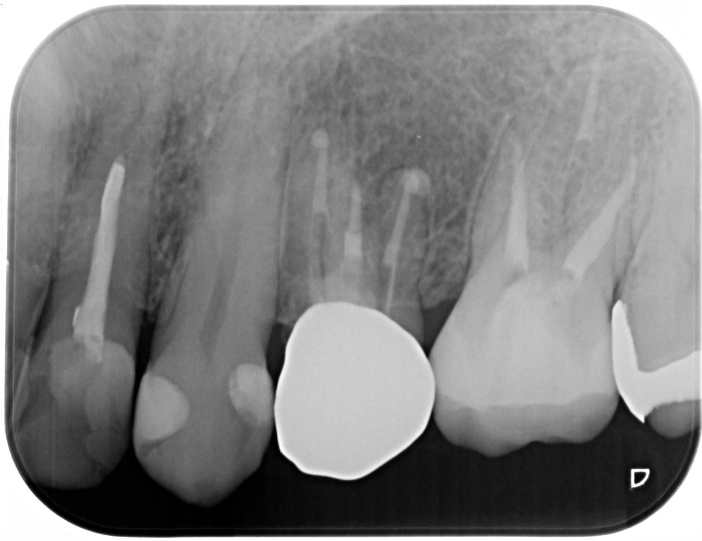 Before image